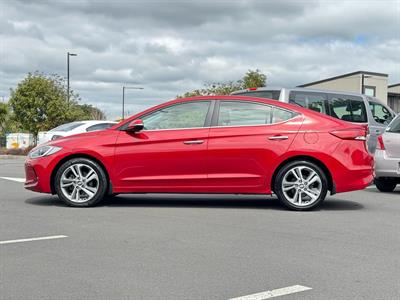 2017 Hyundai ELANTRA - Thumbnail