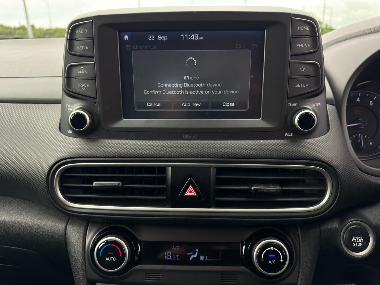 2017 Hyundai Kona