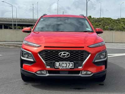 2017 Hyundai Kona - Thumbnail
