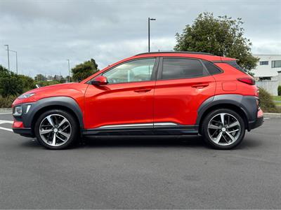 2017 Hyundai Kona - Thumbnail