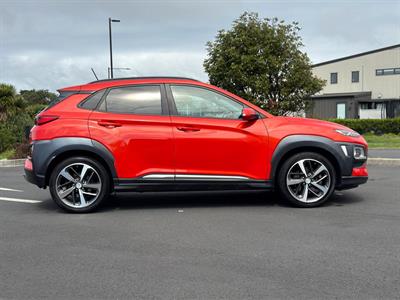 2017 Hyundai Kona - Thumbnail